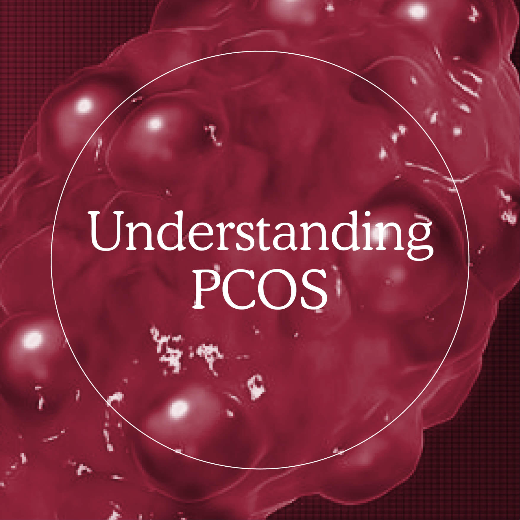 Understanding PCOS – Myoovi